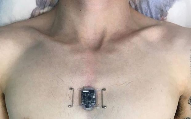 Програміст з Новосибірська імплантував собі в груди компас / фото instagram.com/diakovevgeny