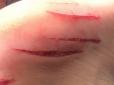Хіти тижня. Таїландська акула порвала японського туриста (фото)