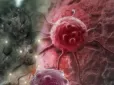 Склянка цього напою може збільшити ризик раку товстої кишки - лікарі б’ють на сполох